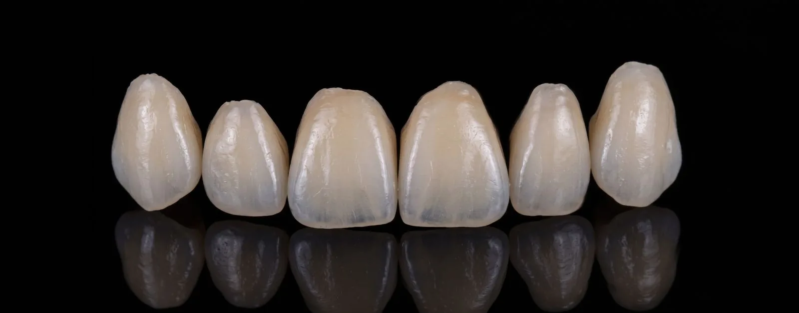 Festsitzender Zahnersatz